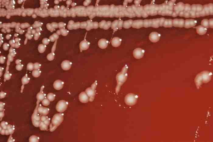 세균 01 62 Salmonella arizona ( 구 Arizona hinshawii) 위험군 : 제 2위험군 국내범주 :- 특성 :Enterobacteriaceae 과, 그람음성, 산소성, 막대균, 편모있음, 운동성있음, 포자형성안함 Salmonella enterica subsp.