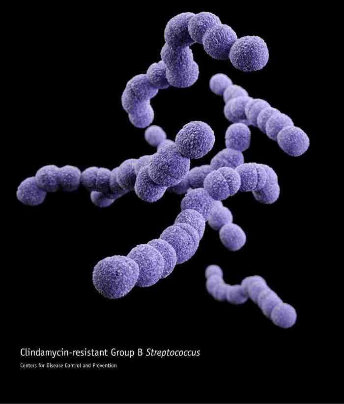2017 병원체생물안전정보집 ( 제 2, 3, 4 위험군 ) 67 Streptococcus agalactiae 위험군 : 제 2위험군 국내범주 :- 특성 :Streptococcaceae과, 그람양성, 사슬알균, 조건무산소성 출처 :CDC/ James Archer 병원성및감염증상 잠복기 : 증상이일찍나타나는경우 7일이내, 증상이늦게나타나는경우는알려지지않음