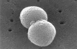 2017 병원체생물안전정보집 ( 제 2, 3, 4 위험군 ) 68 Streptococcus pneumoniae 위험군 : 제 2위험군 국내범주 :- 특성 :Streptococcaceae과, 그람양성, 쌍알균또는짧은알균, 협막있음, 조건무산소성 출처 :CDC/ Dr.