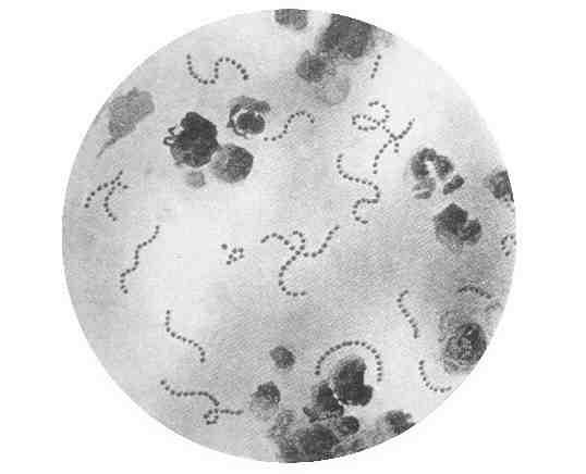 2017 병원체생물안전정보집 ( 제 2, 3, 4 위험군 ) 69 Streptococcus pyogenes 위험군 : 제 2위험군 국내범주 :- 특성 :Streptococcaceae 과, 그람양성, 사슬구균, 산소성 출처 :CDC 병원성및감염증상 잠복기 :1~3일 인두염과화농피부증이가장흔히발생하며, 독소쇼크증후군, 괴사근막염등화농성질병과류머티즘열