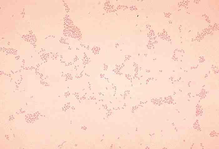 세균 01 2 Actinobacillus spp. 위험군 : 제 2위험군 국내범주 :- 특성 :Pasteurellaceae과, 그람음성, 알균또는짧은막대균, 운동성없음, 포자형성안함, 조건무산소성 출처 :CDC/ Dr. W.A. Clark 병원성및감염증상 잠복기 : 알려지지않음 는사람과동물의입인두에서정상균무리로존재함 가가장흔한인체병원균이고다른균종에의한인체감염은 매우드묾.