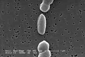 2017 병원체생물안전정보집 ( 제 2, 3, 4 위험군 ) 73 Vibrio parahaemolyticus 위험군 : 제 2위험군 국내범주 :- 특성 :Vibrionaceae과, 그람음성, 막대균, 조건무산소성 출처 :CDC/ Janice Haney Carr 병원성및감염증상 잠복기 :9~25시간(3일),