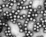 2017 병원체생물안전정보집 ( 제 2, 3, 4 위험군 ) 02 바이러스 1 Astrovirus 출처 :.https://commons.wikimedia.org/ wiki/file:astrovirus_4.