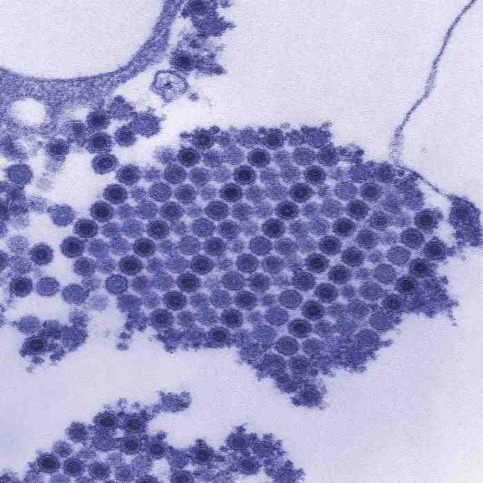 2017 병원체생물안전정보집 ( 제 2, 3, 4 위험군 ) 6 Chikungunya virus 위험군 : 제 3위험군 국내범주 : 전략물자통제병원체 특 성 : 과, 속, (+)ssrna 바이러스, 구형, 피막있음 출처 :CDC/ Cynthia Goldsmith, James A.