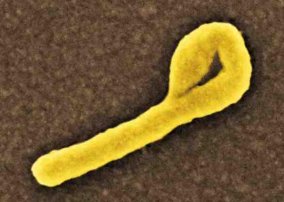 2017 병원체생물안전정보집 ( 제 2, 3, 4 위험군 ) 11 Ebolavirus 출처 :National Institute of Allergy and Infectious Diseases (NIAID) 위험군 : 제 4 위험군 국내범주 : 고위험병원체, 생물작용제, 전략물자통제병원체 특 성 : 과, 속, 5 종이있음.