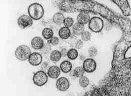 2017 병원체생물안전정보집 ( 제 2, 3, 4 위험군 ) 15 Hantaan virus, Sin Nombre virus 위험군 : 제 3위험군 국내범주 : 전략물자통제병원체 특 성 : 과, 속, (-)ssrna 바이러스, 구형, 피막있음 Sin Nombre virus 출처 :CDC/ Brian W.J. Mahy, PhD; Luanne H.
