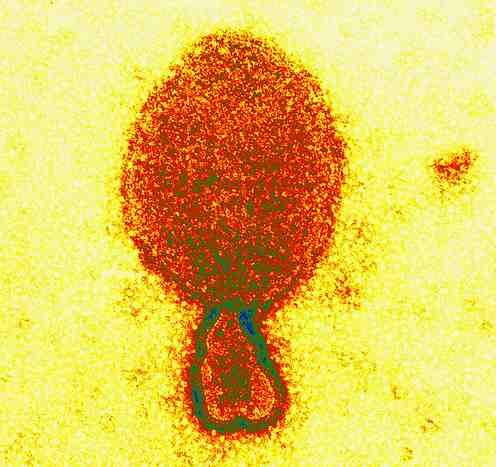 바이러스 02 16 Hendra virus(equine morbillivirus) 위험군 : 제 4위험군 국내범주 : 고위험병원체, 생물작용제, 전략물자통제병원체 특 성 : 과, 속, (-)ssrna 바이러스, 구형, 피막있음 출처 :http://www.scienceimage.csiro.