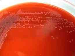세균 01 5 Archanobacterium haemolyticum ( 구. Corynebacterium haemolyticum) 위험군 : 제 2위험군 국내범주 :- 특성 :Actinomycetaceae과, 그람양성, 막대균, 포자형성안함, 산소성 출처 :https://www.flickr.
