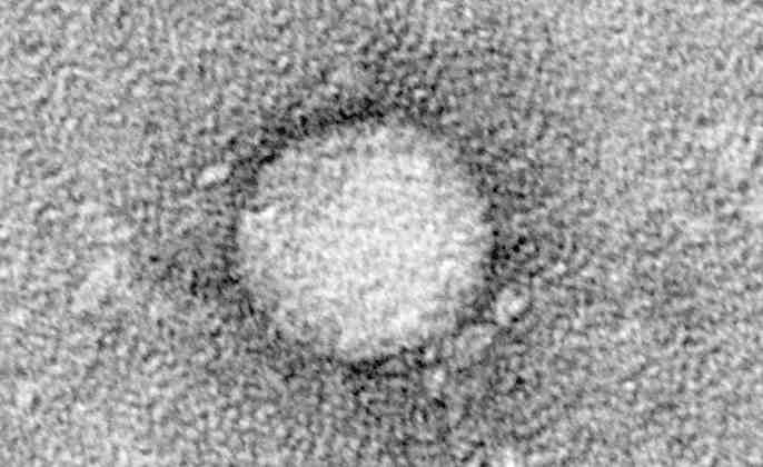 바이러스 02 19 Hepatitis C virus(hcv) 위험군 : 제 2위험군 국내범주 :- 특 성 : 과, 속, (+)ssrna, 외피있음 출처 :Center for the Study of Hepatitis C, The Rockefeller University 병원성및감염증상 잠복기 :15~150일 C형간염 (viral hepatitis C)