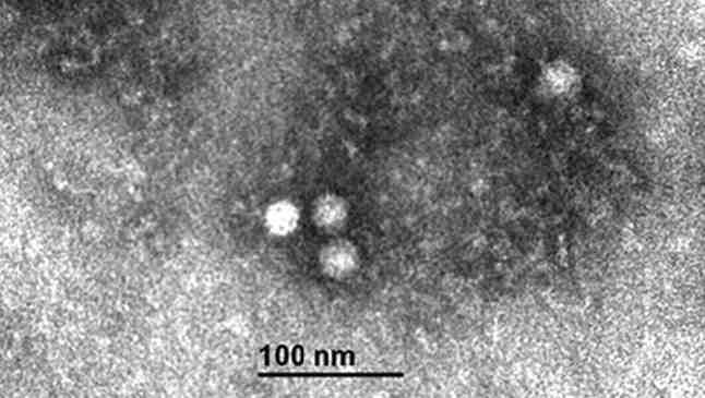 2017 병원체생물안전정보집 ( 제 2, 3, 4 위험군 ) 25 Human bocavirus 위험군 : 제 2위험군 국내범주 :- 특 성 : 과, 속, ssdna, 피막없음 출처 :Tina Ursic, et al. J. Clin. Microbiol. Mar.