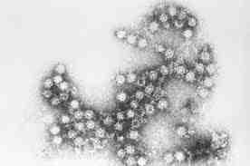 2017 병원체생물안전정보집 ( 제 2, 3, 4 위험군 ) 26 Human coxackieviruses types A, B 위험군 : 제 2위험군 국내범주 :- 특 성 : 과, 속, (+)ssrna, 외피없음 출처 :CDC 병원성및감염증상 잠복기 : 수일 ( 수족구병 ) 에서수년 ( 심근염 ) 으로다양함 A군과 B군으로구분되며, A군은포진성구협염