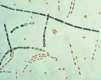 세균 01 6 Bacillus anthracis 위험군 : 제 3위험군 국내범주 : 고위험병원체, 생물작용제, 전략물자통제병원체 특성 :Bacillaceae과, 그람양성, 막대균, 운동성없음, 협막을가짐, 불리한환경조건에서포자형성 출처 :CDC 병원성및감염증상 잠복기 :1~7일( 호흡기탄저의경우최대 60일 ) 2) 탄저를유발하며,