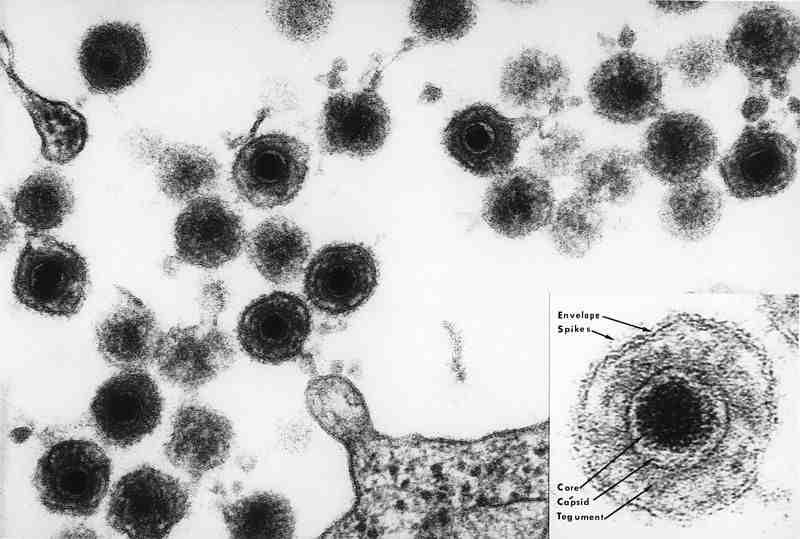 2017 병원체생물안전정보집 ( 제 2, 3, 4 위험군 ) 28 Human herpesvirus type 6, 7 위험군 : 제 2위험군 국내범주 :- 특 성 : 과, 속, dsdna, 정이십면체캡시드, 외피있음 출처 :https://commons.wikimedia.org/ wiki/file:hhv-6_(1).