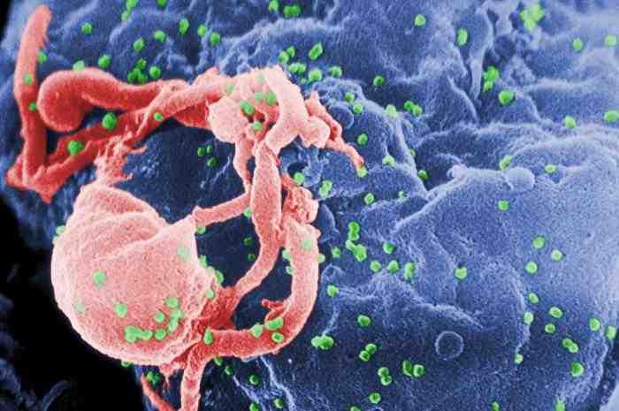 2017 병원체생물안전정보집 ( 제 2, 3, 4 위험군 ) 29 Human immunodeficiency virus(hiv) type 1 and 2 위험군 : 제 3위험군 국내범주 :- 특 성 : 과, 속, 직경 100~110nm, (+)ssrna 바이러스, 외피있음 출처 :CDC/ C. Goldsmith 병원성및감염증상 잠복기 : 다양함.