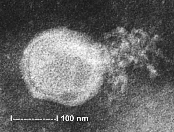 바이러스 02 30 Human metapneumovirus 위험군 : 제 2위험군 국내범주 :- 특성 : 과, 속, (-)ssrna, 피막있음 출처 :Chan RC, et al. Emerg Infect Dis.