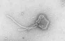 바이러스 02 34 Human respiratory syncytial virus 위험군 : 제 2위험군 국내범주 :- 특성 : 과, 속, (-)ssrna, 외피있음 출처 :Robert Koch-Institut/ Hans R.