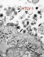 바이러스 02 36 Human T cell lymphotropic virus (HTLV) type 1 and 2 위험군 : 제 3위험군 국내범주 :- 특 성 : 과, 속, 직경약 100nm, 구형, (+)ssrna 바이러스 출처 :CDC/ Cynthia Goldsmith 병원성및감염증상 잠복기 :HTLV 1 감염후 20~30 년후증상나타남.