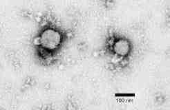 2017 병원체생물안전정보집 ( 제 2, 3, 4 위험군 ) 40 Lymphocytic choriomeningitis virus 위험군 : 제 3위험군 국내범주 :- 특 성 : 과, 속, (-)ssrna, 원형, 계란형등다형태, 외피있음 출처 :Erik S. Foster, et al.