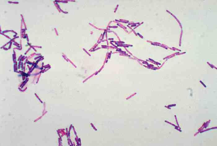 2017 병원체생물안전정보집 ( 제 2, 3, 4 위험군 ) 7 Bacillus cereus 출처 :CDC/ Dr. William A.