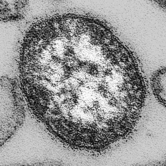 2017 병원체생물안전정보집 ( 제 2, 3, 4 위험군 ) 42 Measles virus 위험군 : 제 2위험군 국내범주 :- 특 성 : 과, 속, (-)ssrna 바이러스, 나선형뉴클레오캡시드, 외피있음 출처 :CDC/ Cynthia S.
