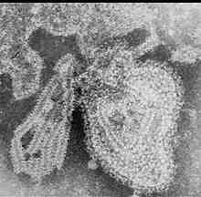 2017 병원체생물안전정보집 ( 제 2, 3, 4 위험군 ) 45 Mumps virus 위험군 : 제 2위험군 국내범주 :- 특 성 : 과, 속, (-)ssrna, 외피있음 출처 :CDC/ F. A. Murphy 병원성및감염증상 잠복기 :14~18일 급성발열성질환인유행성이하선염 (mumps) 를유발함 감염후발열, 두통, 근육통, 구토등을보임.