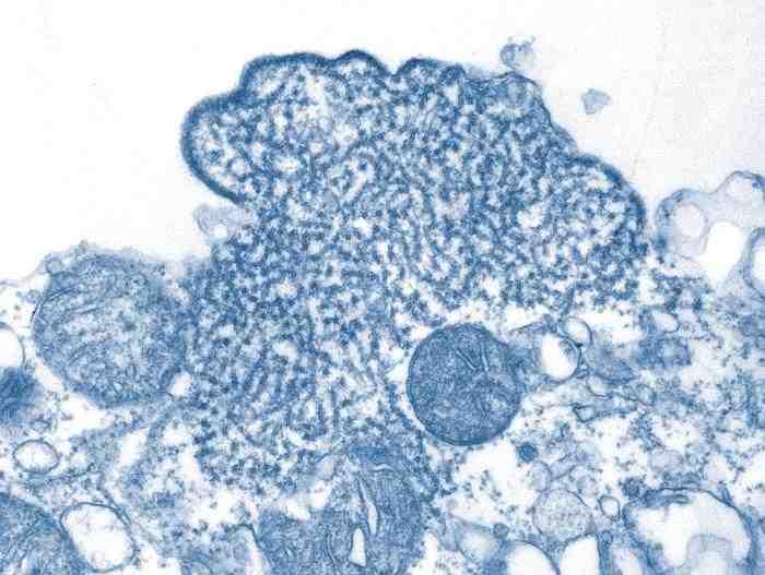 2017 병원체생물안전정보집 ( 제 2, 3, 4 위험군 ) 48 Nipah virus 위험군 : 제 4위험군 국내범주 : 고위험병원체, 생물작용제, 전략물자통제병원체 특 성 : 과, 속, (-)ssrna 바이러스, 구형, 피막있음 출처 :CDC/ C. S. Goldsmith, P. E.