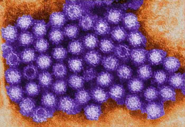 2017 병원체생물안전정보집 ( 제 2, 3, 4 위험군 ) 49 Norovirus(Norwalk virus) 위험군 : 제 2위험군 국내범주 :- 특 성 : 과, 속, (+)ssrna, 외피없음 출처 :CDC/ Charles D.