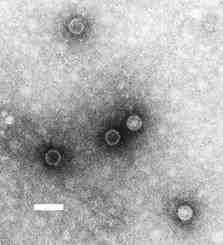 2017 병원체생물안전정보집 ( 제 2, 3, 4 위험군 ) 51 Poliovirus 위험군 : 제 2위험군 국내범주 :- 특 성 : 과, 속, (+)ssrna, 외피없음 출처 :http://www.epa.gov/nerlcwww/ polio.html F.P. Williams, U.S.