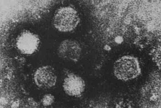 2017 병원체생물안전정보집 ( 제 2, 3, 4 위험군 ) 52 Powassan virus 위험군 : 제 3위험군 국내범주 : 전략물자통제병원체 특 성 : 과, 속, (+)ssrna 바이러스, 피막있음 출처 :K.S.E. Abdelwahab, et al., Canad. Med. Ass. J. May 2, 1964, vol.