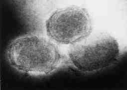 2017 병원체생물안전정보집 ( 제 2, 3, 4 위험군 ) 53 Poxviruses (Monkeypox virus, Alastrim, Smallpox, Whitepox 를포함한일부제한된 Poxviruses 를제외한전종 ) 위험군 : 제 2위험군 국내범주 :- 특 성 : 과, dsdna, 타원형에서벽돌 모양까지다양함 출처 :CDC 병원성및감염증상 잠복기