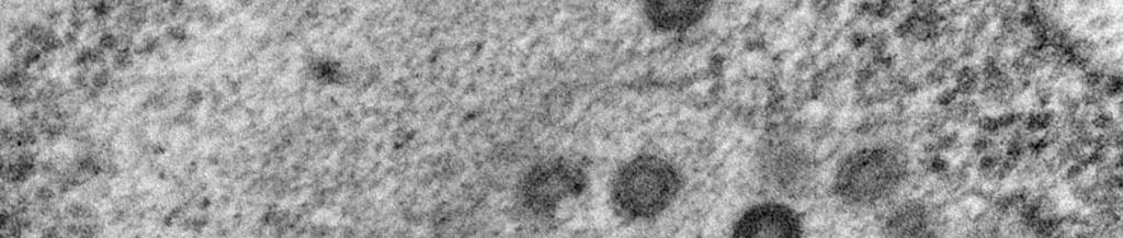 바이러스 02 55 Rabies virus 위험군 : 제 3위험군 국내범주 : 전략물자통제병원체 특성 :