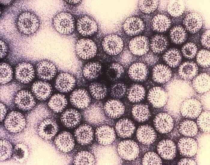 2017 병원체생물안전정보집 ( 제 2, 3, 4 위험군 ) 56 Reoviridae (Coltivirus 속, Orbivirus 속, Rotavirus 속을포함한전종 ) 위험군 : 제 2위험군 국내범주 :- 특 성 : 과, dsrna, 외피없음 출처 :CDC/ Dr.
