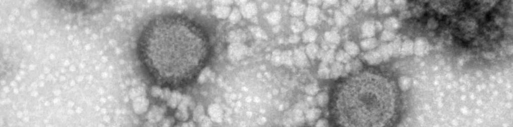 Rift Valley fever virus MP12 출처 :Robert Koch-Institut 병원성및감염증상 잠복기 :2~6일