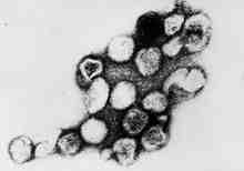 2017 병원체생물안전정보집 ( 제 2, 3, 4 위험군 ) 59 Rubella virus 위험군 : 제 2위험군 국내범주 :- 특 성 : 과, 속, (+)ssrna, 외피 있음 출처 :CDC/ Erskine Palmer 병원성및감염증상 잠복기 :12~23일( 일반적으로 14일 ) 급성발열성질환인풍진 (rubella) 를유발함 선천성풍진증후군은선천성백내장