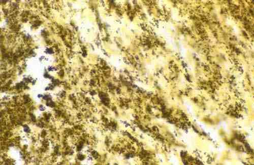 2017 병원체생물안전정보집 ( 제 2, 3, 4 위험군 ) 9 Bartonella henselae 위험군 : 제 2위험군 국내범주 :- 특성 :Bartonellaceae 과, 그람음성, 짧은막대균, 산소성 출처 :Houpikian P, Raoult D. Emerg Infect Dis.