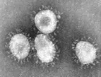 2017 병원체생물안전정보집 ( 제 2, 3, 4 위험군 ) 61 SARS CoV (Severe acute respiratory syndrome coronavirus) 위험군 : 제 3위험군 국내범주 : 고위험병원체, 생물작용제, 전략물자통제병원체 특성 : 과, 속, (+)ssrna 바이러스, 피막있음, 왕관모양 출처 :CDC/ Dr.