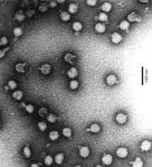 바이러스 02 63 Semliki Forest virus 위험군 : 제 3위험군 국내범주 :- 특 성 : 과, 속, (+)ssrna 바이러스 출처 :https://commons.wikimedia.org/ wiki/file:semliki-forest-virus.