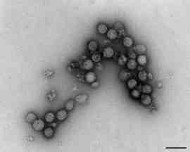 바이러스 02 65 Sindbis virus 위험군 : 제 2위험군 국내범주 :- 특 성 : 과, 속, (+)ssrna, 외피있음 출처 :Robert Koch-Institut/ Hans R.