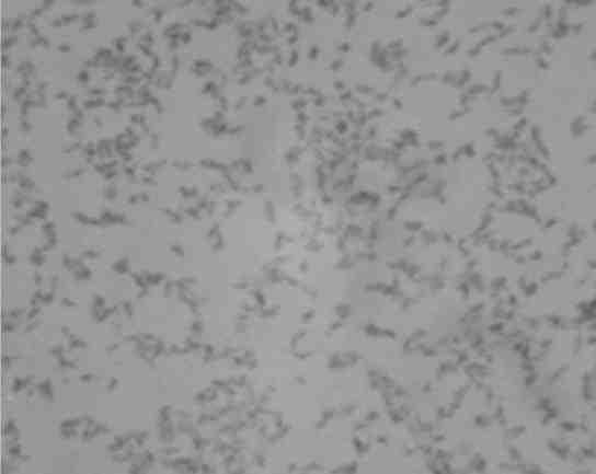 2017 병원체생물안전정보집 ( 제 2, 3, 4 위험군 ) 10 Bartonella quintana 위험군 : 제 2위험군 국내범주 :- 특성 :Bartonellaceae 과, 세포내기생, 그람음성, 짧은막대균, 조건무산소성 출처 :J. M. Rolain, et al. Antimicrob Agents Chemother.