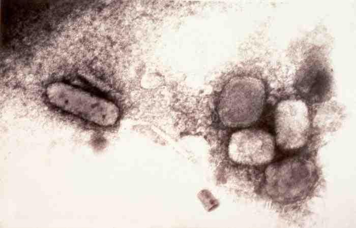 바이러스 02 71 Variola virus 위험군 : 제 4위험군 국내범주 : 고위험병원체, 생물작용제, 전략물자통제병원체 특 성 : 과, 속, dsdna 바이러스, 벽돌모양 (brick-shaped), 피막있음 출처 :CDC/ Dr. Kenneth L.