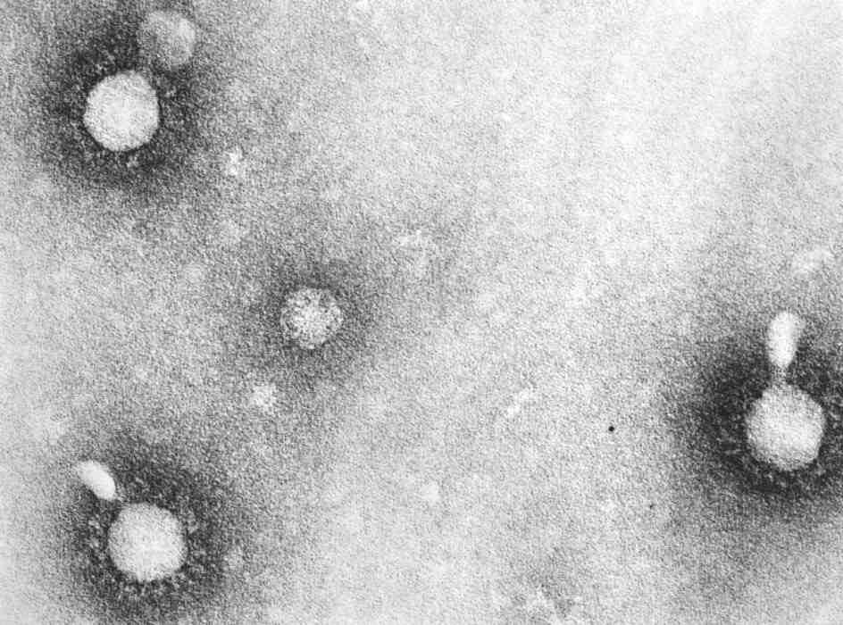 2017 병원체생물안전정보집 ( 제 2, 3, 4 위험군 ) 72 Venezuelan equine encephalitis virus 위험군 : 제 3위험군 국내범주 : 고위험병원체, 생물작용제, 전략물자통제병원체 특 성 : 과, 속, (+)ssrna 바이러스, 피막있음 출처 :CDC/ Dr.