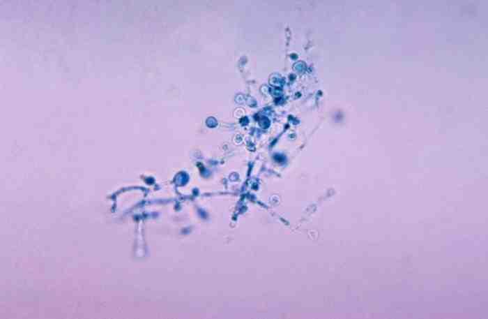 진균 03 3 Blastomyces dermatitidis 위험군 : 제 3위험군 국내범주 :- 특성 :Ajellomycetaceae 과, 두형태진균 (Dimorphic fungi), 북아메리카, 미국오하이오미시시피강계곡에주로분포함 출처 :CDC/ Dr.