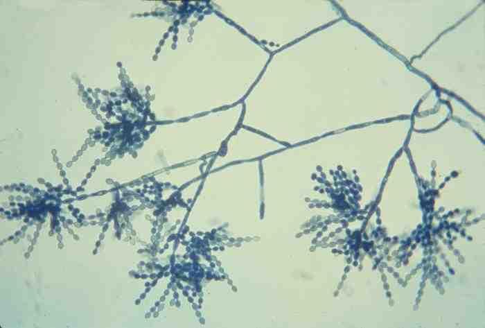 진균 03 5 Cladophialophora spp. 위험군 : 제 2위험군 국내범주 :- 특성 :Herpotrichiellaceae과, 10종류의병원성종이있으며사람에서는 7종류가감염을일으킴 출처 :CDC/Dr. Lucille K.