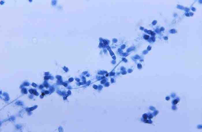 진균 03 6 Coccidioides spp. (Coccidioides immitis, C. posadassi) C. immitis 출처 :CDC/Dr. Lucille K.