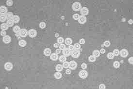 진균 03 7 Cryptococcus spp. 출처 :CDC/ Dr. Leanor Haley 병원성및감염증상 위험군 : 제 2 위험군 국내범주 :- 특 잠복기 : 숙주에따라수일에서수주 성 : 난원형의지름 3~15 μm효모균. 두터운협막에 쌓여있는것이많고분아에의해증식.