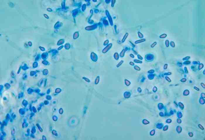 진균 03 8 Emmonsia spp. E. parva 출처 :CDC/ Dr.