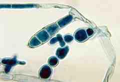 진균 03 9 Epidermophyton floccosum 위험군 : 제 2위험군 국내범주 :- 특성 :Arthrodemataceae과 출처 :CDC/Dr.