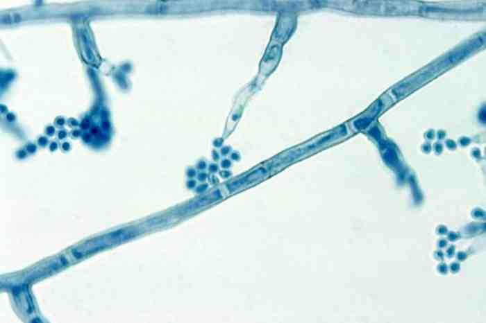진균 03 14 Madurella mycetomatis 위험군 : 제 2위험군 국내범주 :- 특성 :Incertaesedis과 출처 :CDC/Dr. Lucille K.