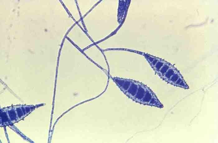 진균 03 15 Microsporum spp. 위험군 : 제 2위험군 국내범주 :- 특성 :Arthrodermataceae과 출처 :CDC/Dr. Lucille K.
