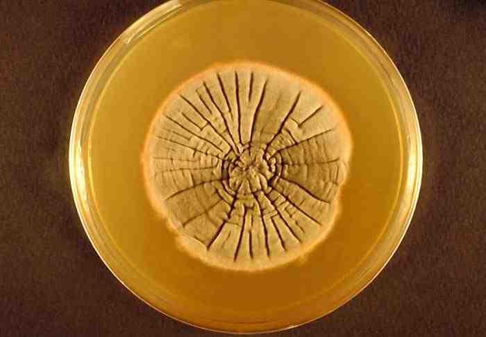 진균 03 16 Neotestudina rosati 위험군 : 제 2위험군 국내범주 :- 특성 :Testudinaceae과 출처 :CDC 병원성및감염증상 잠복기 : 숙주에따라수주에서수개월